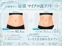 クロエビューティー 麻布十番店(クロエbeauty)の雰囲気（マイクロウェーブ/毛穴/ハーブピーリング/マイクロ波リフト）