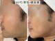 ハナコ 下通店(HANAKO)の写真/男女ともに対応、お手入れお任せください◎清潔感ある素肌で自信を持って出かけましょう♪