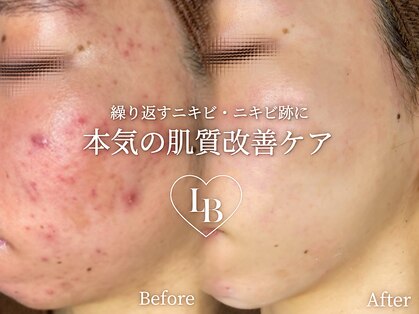 ラティーナ(Lattina)の写真