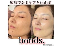 ボンズ(bonds.)