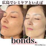 ボンズ(bonds.)