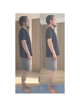 エヌホープ(N hope)/姿勢不良　改善するなら呼吸