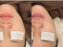 グレイスリリー 久屋 栄(grace lily)/