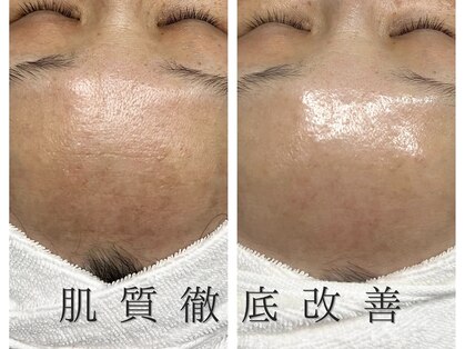 ミレボ 川内店(Me.rebo)の写真