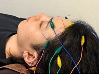 つばさ鍼灸院の写真/【頭が重い・眠りが浅いそんな方へオススメ☆】頭のコリをほぐして疲れ目や頭痛の改善にも◎