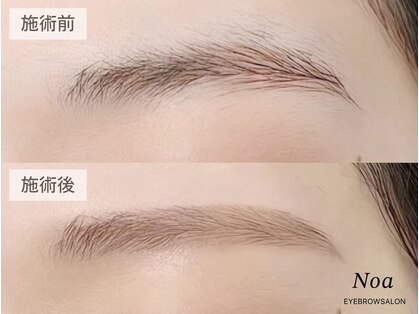 ノア 表参道(Noa)の写真