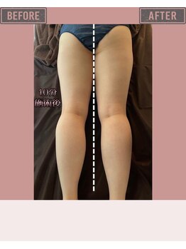 マーリエ(Malie)/【オールハンド】脚