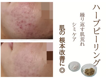 ウォーマル(warmaL)の写真