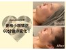 【Aimi 指名限定】強烈小顔矯正！熟練の手技で結果重視の60分♪