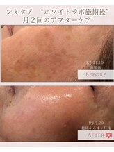 エクラ アン(eclat.un)/ホワイトラボ