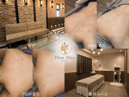 フルール ニコ(Fleur Nico)の写真