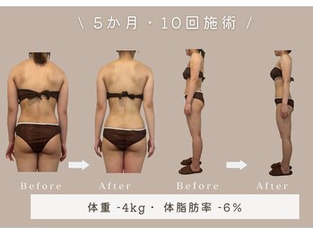 マリーズウィル(MARY's WILL)の写真/【歪み×巡り×温めの3step】コリ・むくみを根本から整える！美容整体×全身リンパ×真菰蒸し★