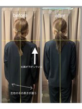 アイリー(Irie)/骨格矯正