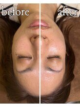 4515/お客様Before After