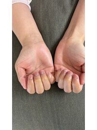自爪ネイルケア