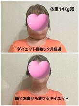 マナ(mana)/5ヶ月で別人級の小顔☆