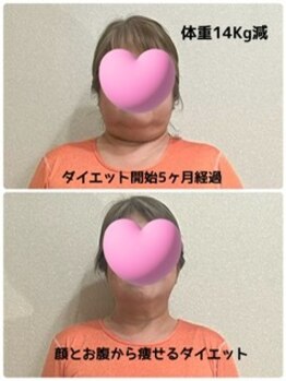 マナ(mana)/5ヶ月で別人級の小顔☆