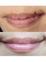ローマピンク 札幌/唇のくすみはRomaPink☆