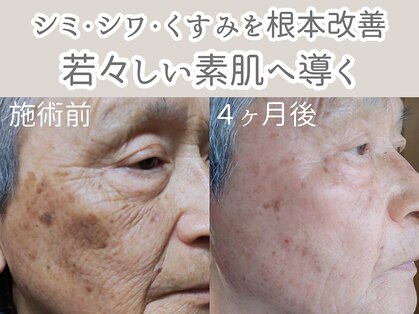 アルカンシエル(arcenciel)の写真