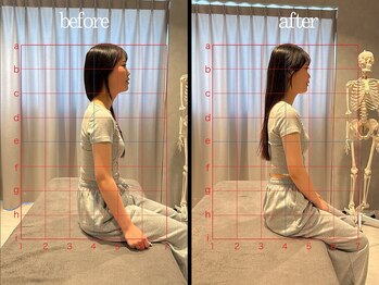 ミトノウ(MITONOU)/姿勢矯正