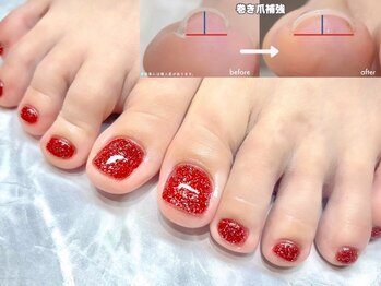 オー 町田モディ店(Oh!)の写真/【フットネイル専門店】巻き爪、足の深爪などのお悩みもお任せ！フットケア&カラーで足元から魅力的に！