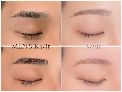 ラヴィール Ravir エステティックサロンの写真