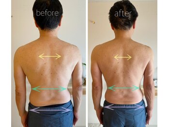 パル コルギサロン(Pal. Korugi salon)/メンズコルギビフォーアフター