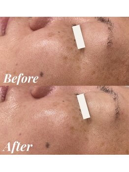 シェリール(Cherir)/ハーブトリートメント