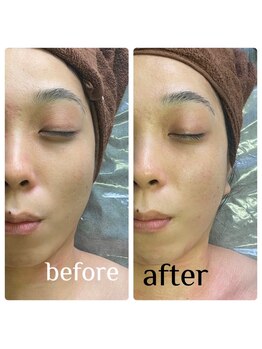 リベル(Liber)/目元美人エクシリス