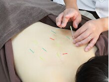 ヘルシースリムウエダ/首・肩・腰ケア【ひばりヶ丘/鍼