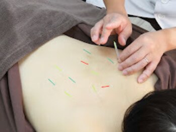 ヘルシースリムウエダ/首・肩・腰ケア【ひばりヶ丘/鍼