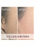 【うなじ+もみあげ】アップヘア・晴れ舞台に◎お得SET￥6500→￥6000