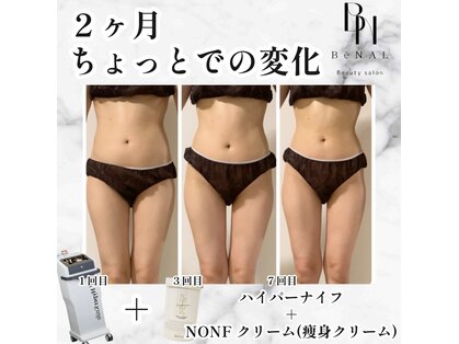 ビナル(BeNAL)の写真