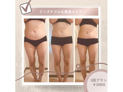 トータルスキンケア キュララ(Kyurara)の写真