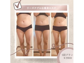 トータルスキンケア キュララ(Kyurara)