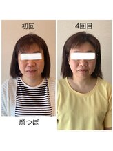 グラナダ 2F(Granada)/