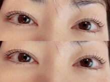 ユーロ(EURO)/上下のラッシュリフト