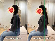 グレフル鍼灸接骨院 整体院 心斎橋/