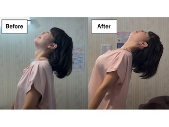 ブレア 銀座/BeforeAfter【鍼灸/カッピング】