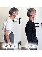 アマテル(AMATERU)/Before/After5