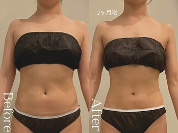 ユーフォリア グロウ(euphoria glow)/{ ラフォス痩身90分 10回 }