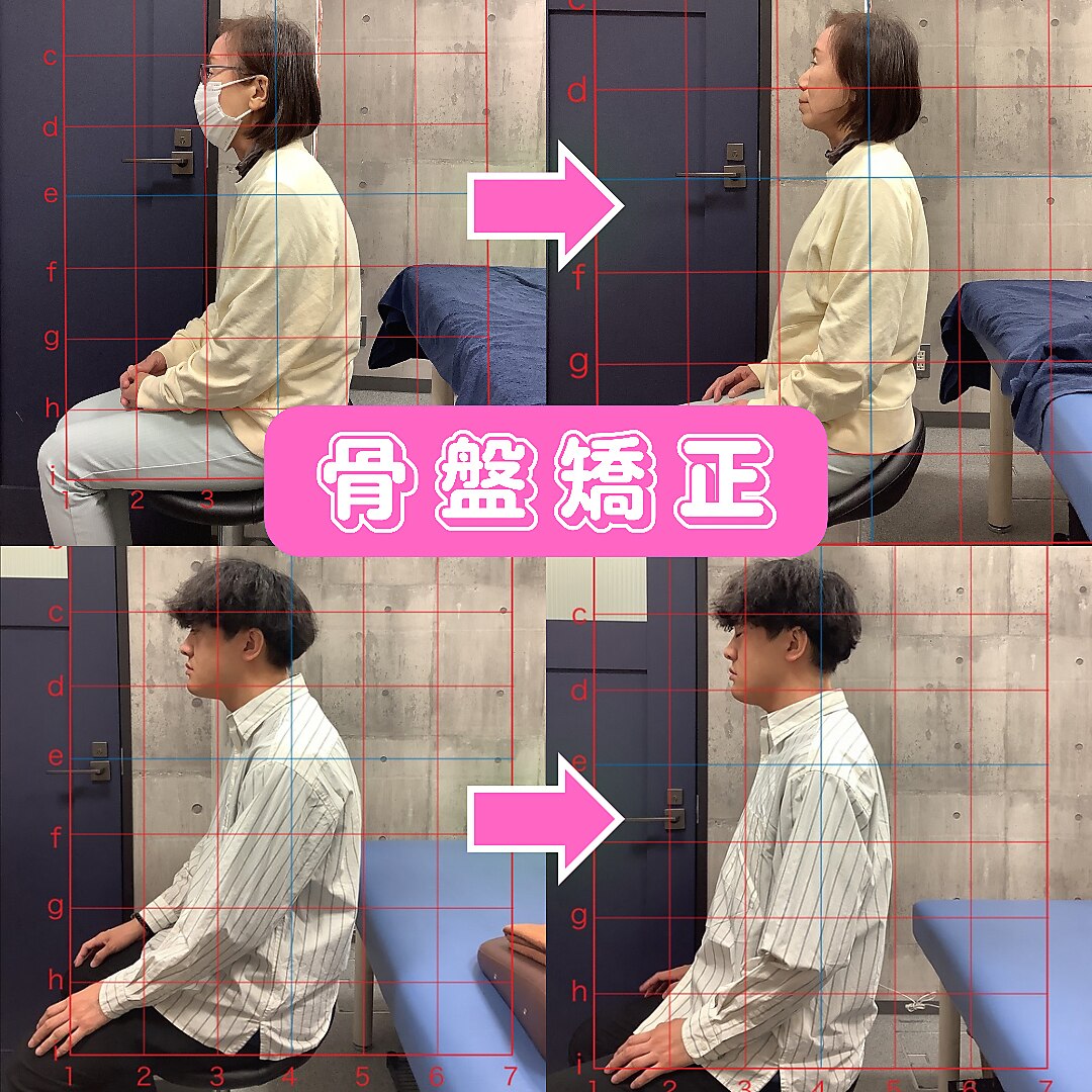 【腰痛・反り腰・猫背改善】歪んだ体に骨格矯正＋全身整体