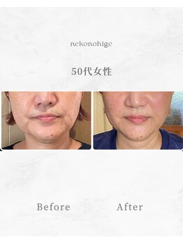 ねこのひげ/お客さんの変化