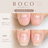 ロコ(ROCO)