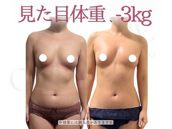 バストアップ&バストケア専門サロン CANBELLE 【キャンベル】の写真/【骨格から美ボディへ】全身の歪みをリセットし理想のメリハリ体型へ◎