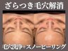 【その毛穴諦めないで】角栓/黒ずみ対策毛穴洗浄+韓国スノ-ピーリング￥6600★