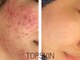 トップスキン 名駅(TOPSKIN)の写真