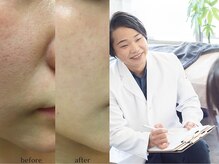 ヒーリングハーツ(Healing Hearts)の雰囲気（結果だし◎しっかりカウンセリングを行い理想の肌へ導きます！）