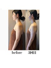 語 かたりべ/エステ　ビフォー・アフター