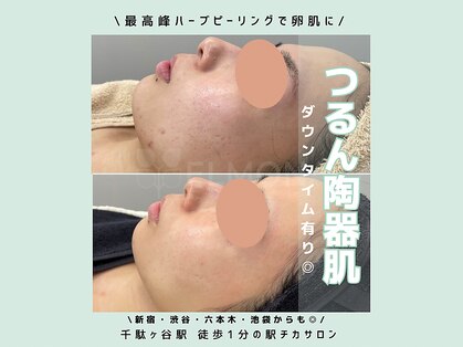 グリーンピール エルモナ(GREENPEEL ELMONA)の写真